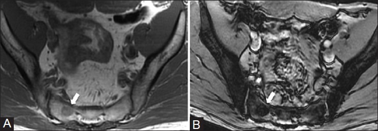 Figure 1 (A and B)