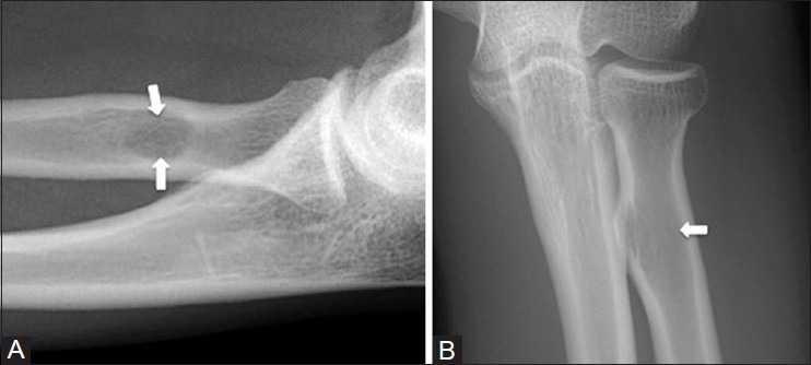 Figure 25 (A and B)