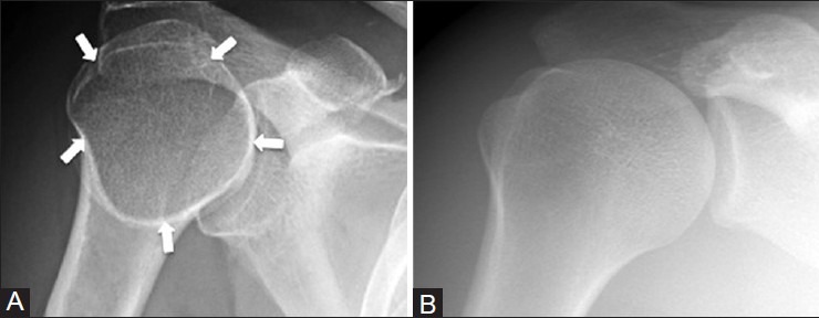 Figure 24 (A and B)