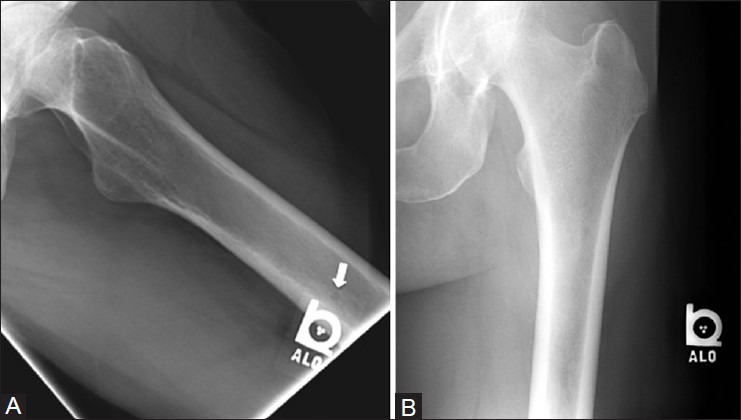 Figure 28 (A and B)