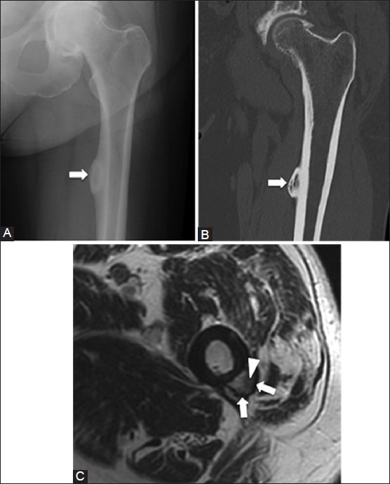 Figure 10 (A-C)