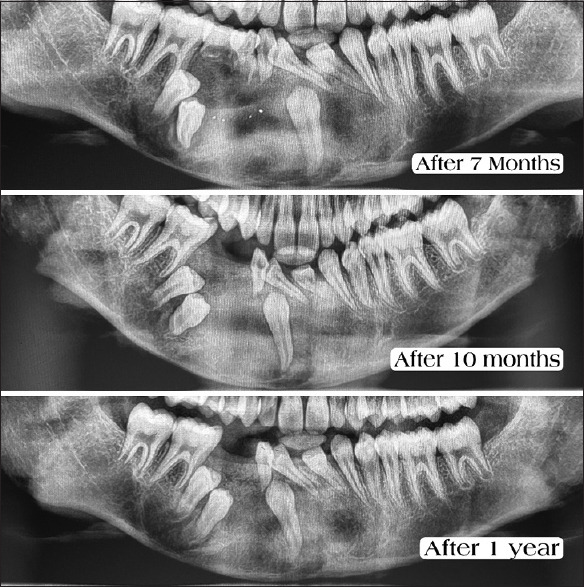 Figure 10