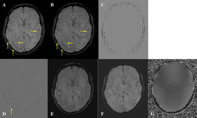 Fig. 9