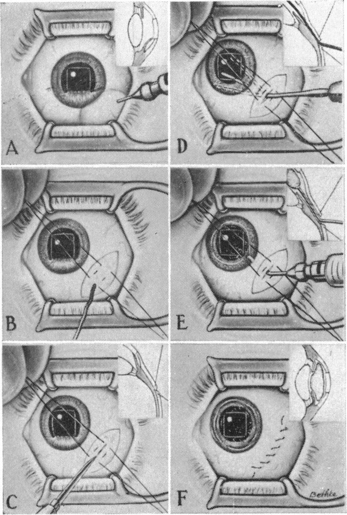 Fig. 11.