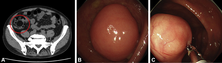 Figure 1