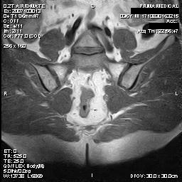 Fig.2