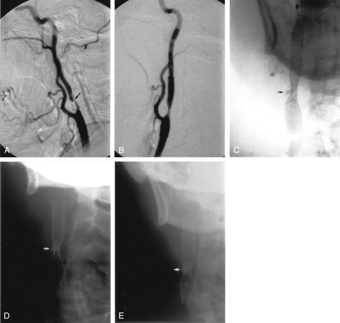 Fig 6.