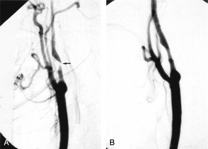 Fig 1.