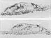 1420-4