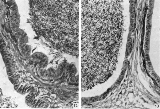 Fig. 12, 13