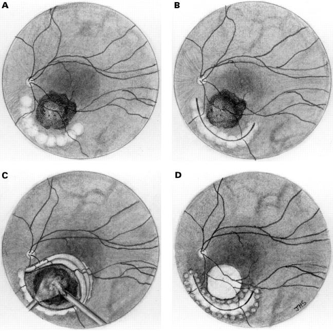 Figure 1  