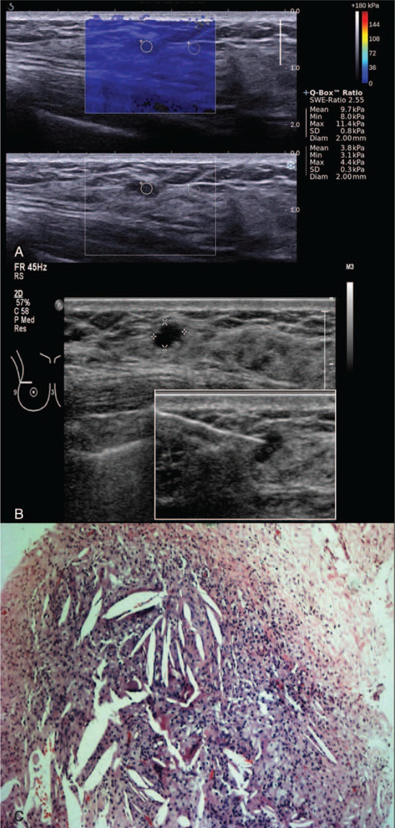 FIGURE 3