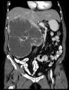 Fig. 1a.