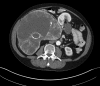 Fig. 1b.