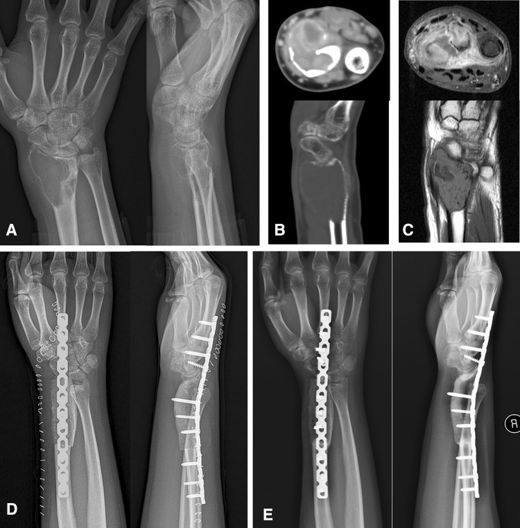 Fig. 1A–E