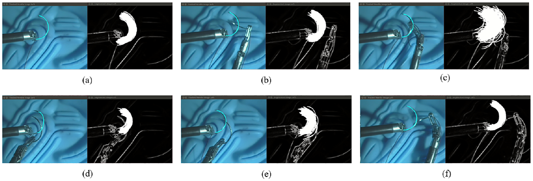 Fig. 12.