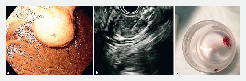 Fig. 1