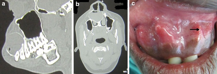 Fig. 2