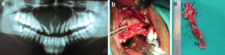 Fig. 3