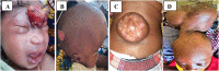 Fig. 1