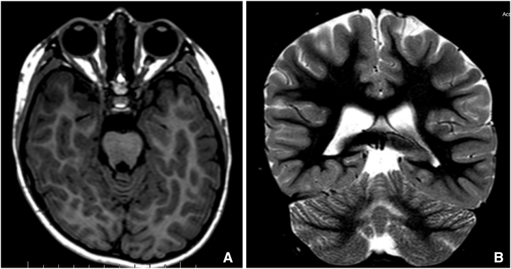 Figure 2