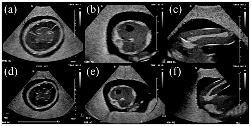 Fig. 18