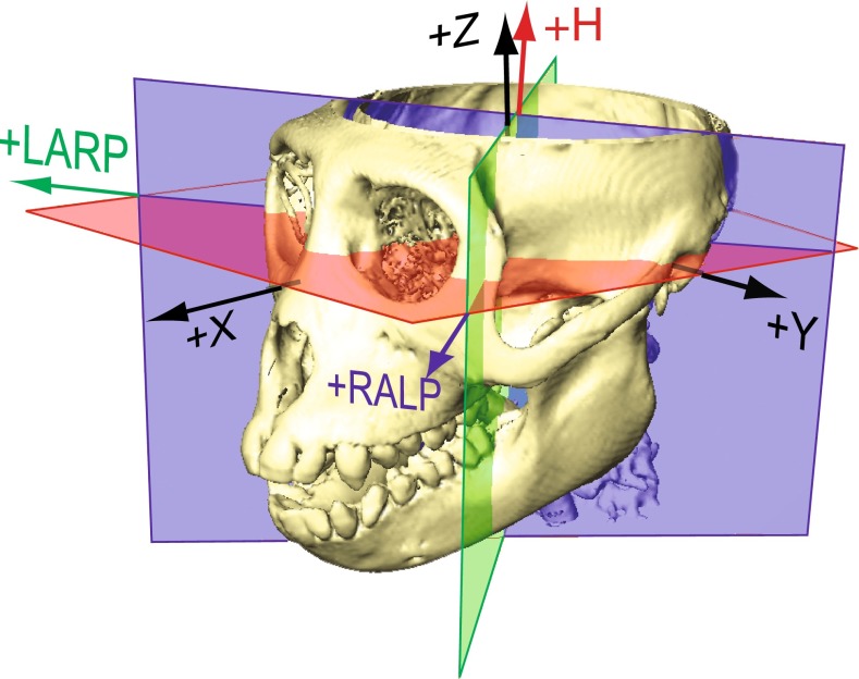 FIG. 1