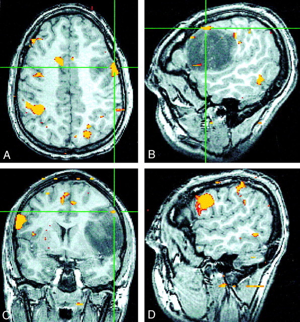 Fig 3.