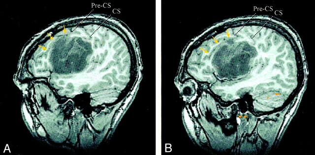 Fig 1.