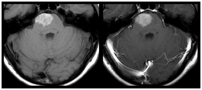 Figure 16