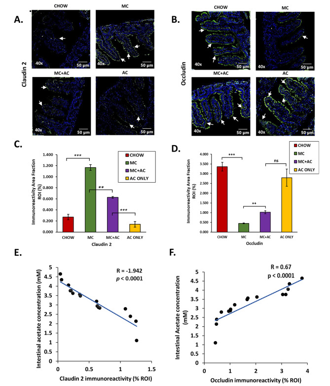 Host Microbiome Associated Low Intestinal Acetate Correlates With 