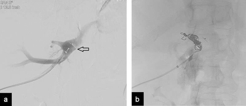 Fig. 10