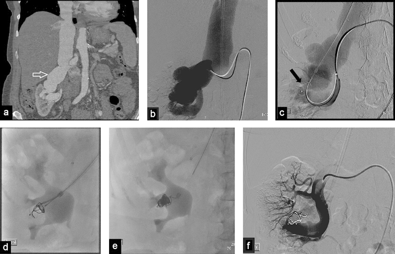 Fig. 6