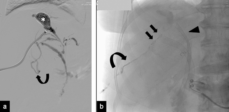 Fig. 11