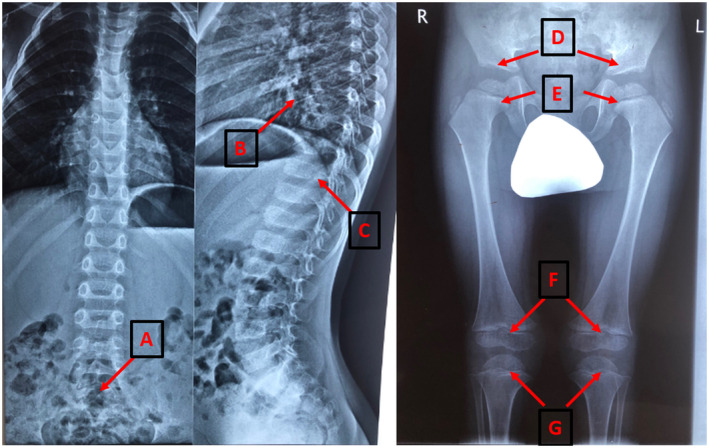 FIGURE 1