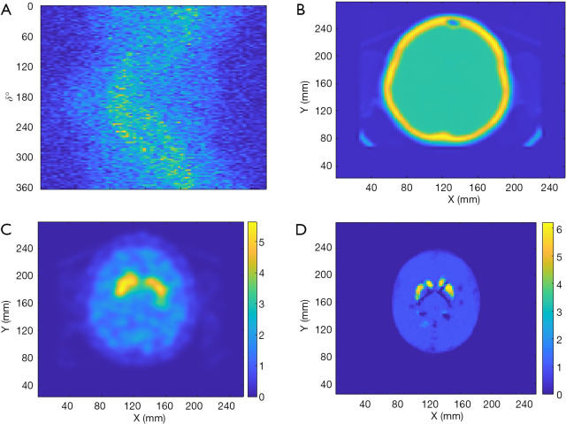 Figure 11