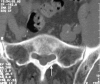 Fig. 5