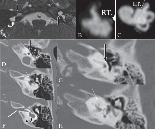 Figure 4 (A-H)