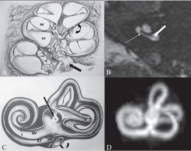 Figure 2 (A-D)