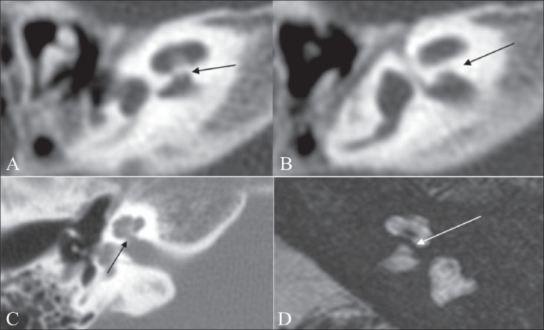 Figure 10 (A-D)