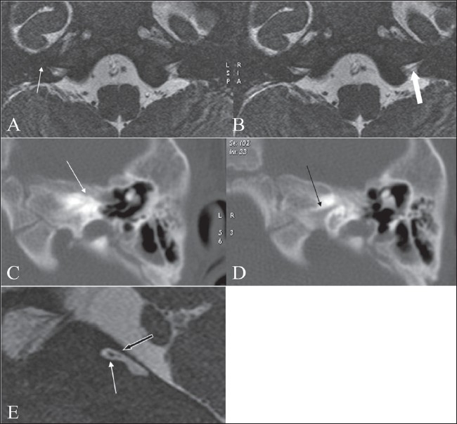 Figure 3 (A-E)