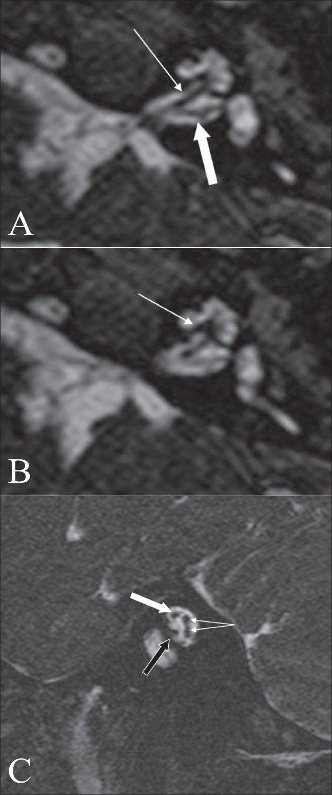 Figure 1 (A-C)