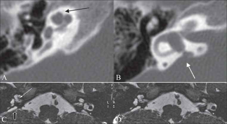 Figure 7 (A-D)