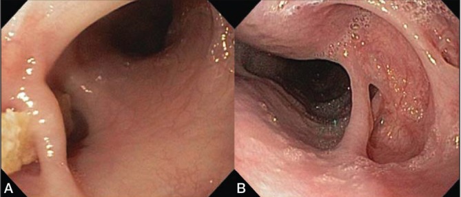 Figure 2)