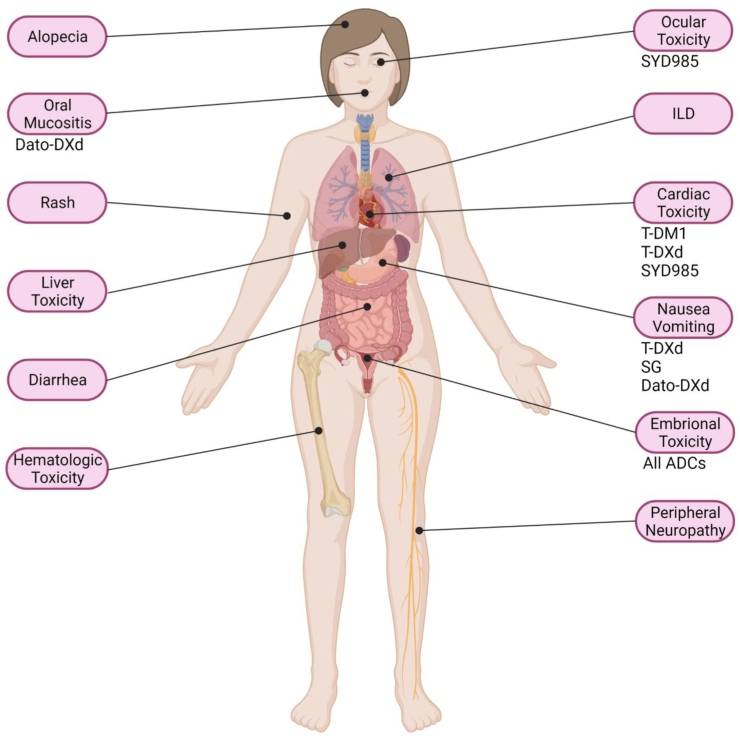 Fig. 1