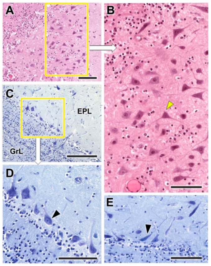 Figure 13