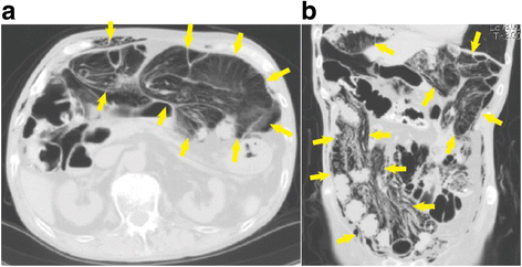 Fig. 1