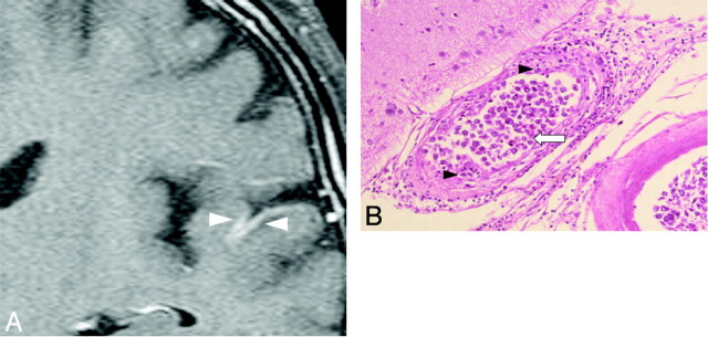 Fig 3.