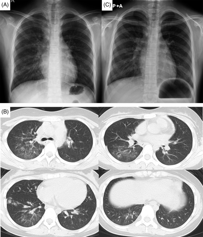 FIGURE 1