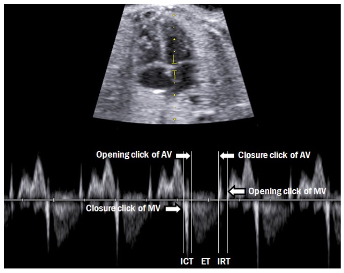 Fig. 14